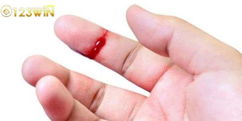 Mơ Thấy Máu: Bí Ẩn Và Giải Mã Chi Tiết Giấc Mơ Huyền Bí 3 Các tình huống khác nhau có thể xảy ra khi mơ thấy máu